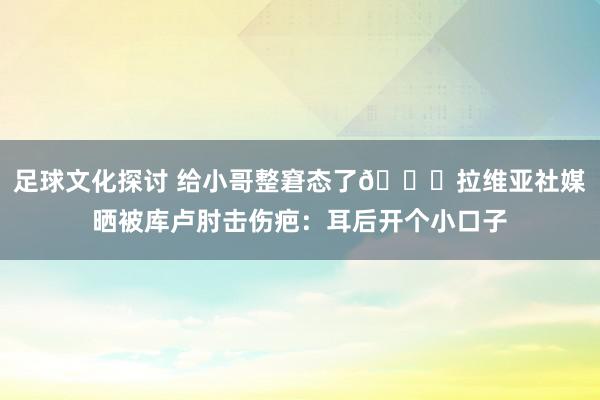 足球文化探讨 给小哥整窘态了😅拉维亚社媒晒被库卢肘击伤疤：耳后开个小口子